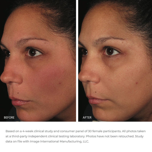ORMEDIC antioxidant serum before and after results