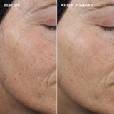 AGELESS+ retinol 0.3% before and after 4 weeks