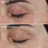 AGELESS+ retinol repair crème before and after 4 weeks